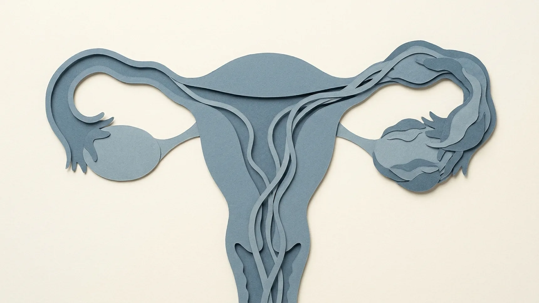 청회색 종이로 오린 자궁과 자궁경부, 양쪽 나팔관과 난소 — 경부에서 자궁을 지나 나팔관으로 물결선이 거슬러 오르고, 한쪽 나팔관 끝이 부어 오그라든 채 난소에 엉겨 붙은 모습으로 위로 올라간 감염을 보여 줍니다